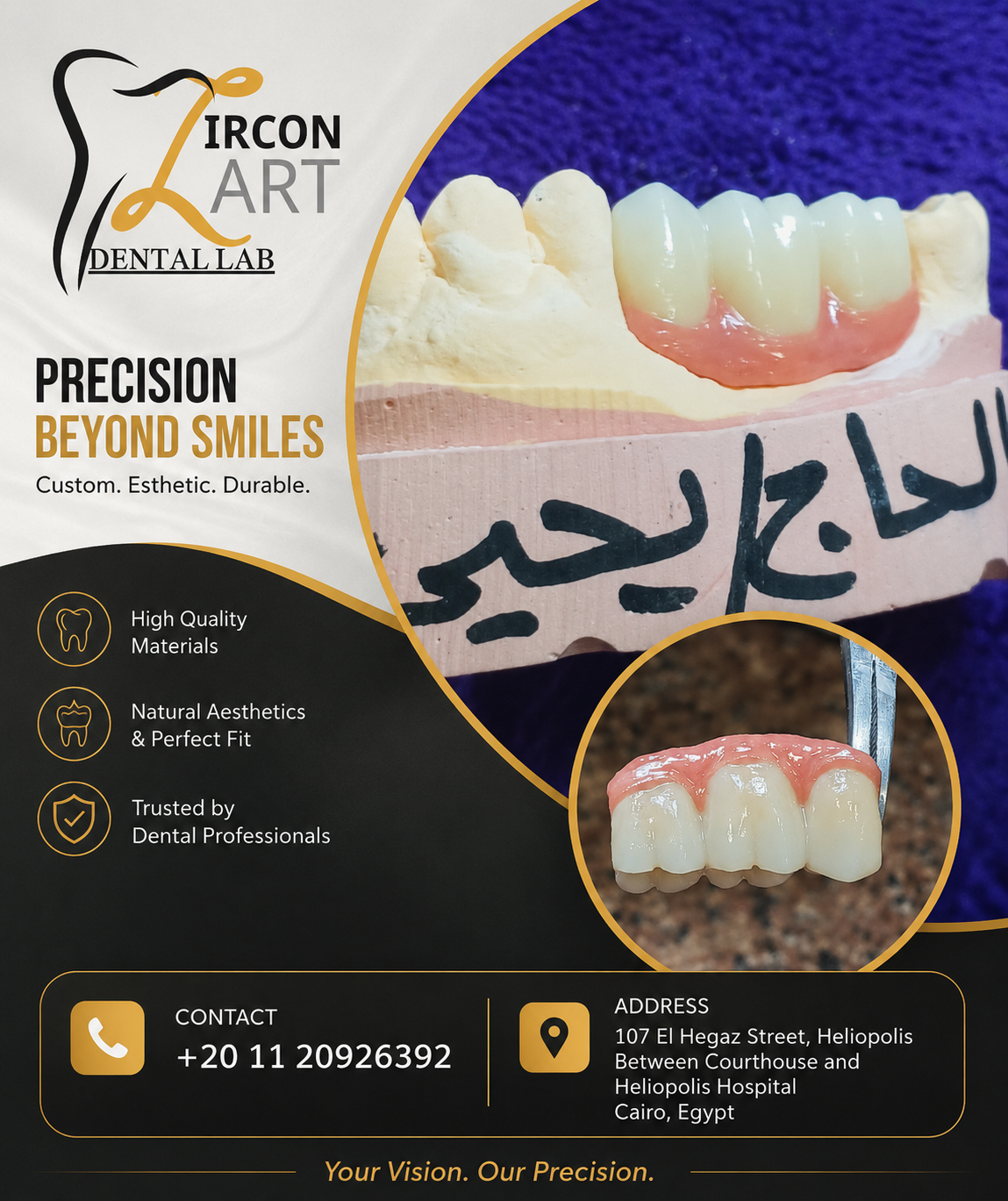 Detailed layered zirconia anterior restoration on a dental model by Zircon Art Dental Laboratory